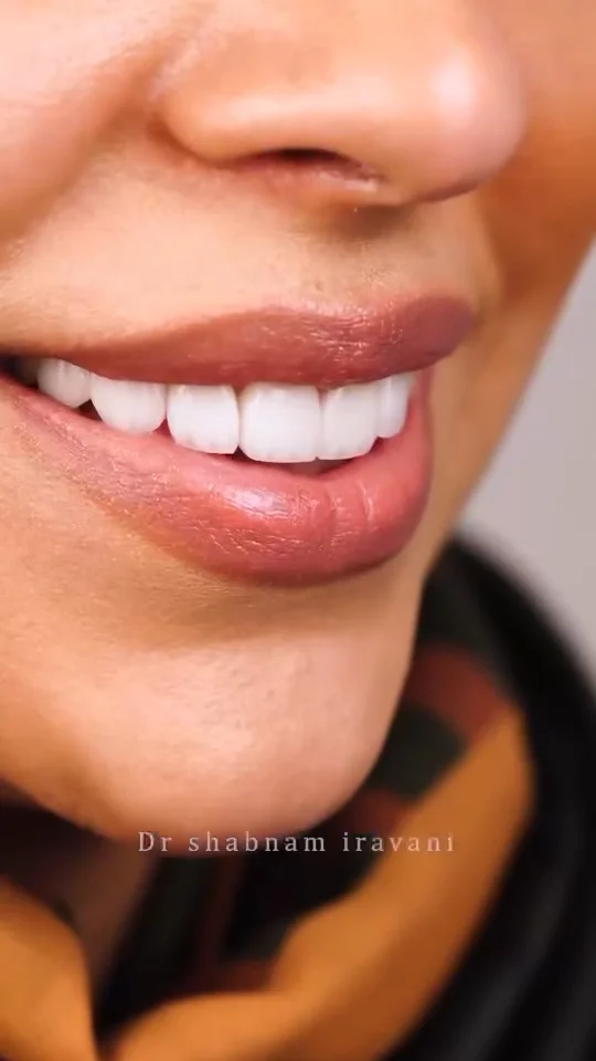 Boushehr Smile video — dental